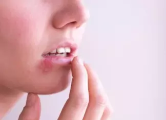 Prueba Gratis Urgo Calenturas