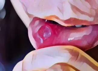 Prueba Gratis hasta 7 Productos Urgo